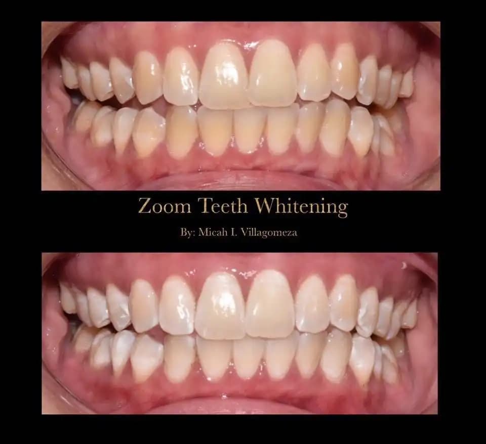 Dental Treatment Result