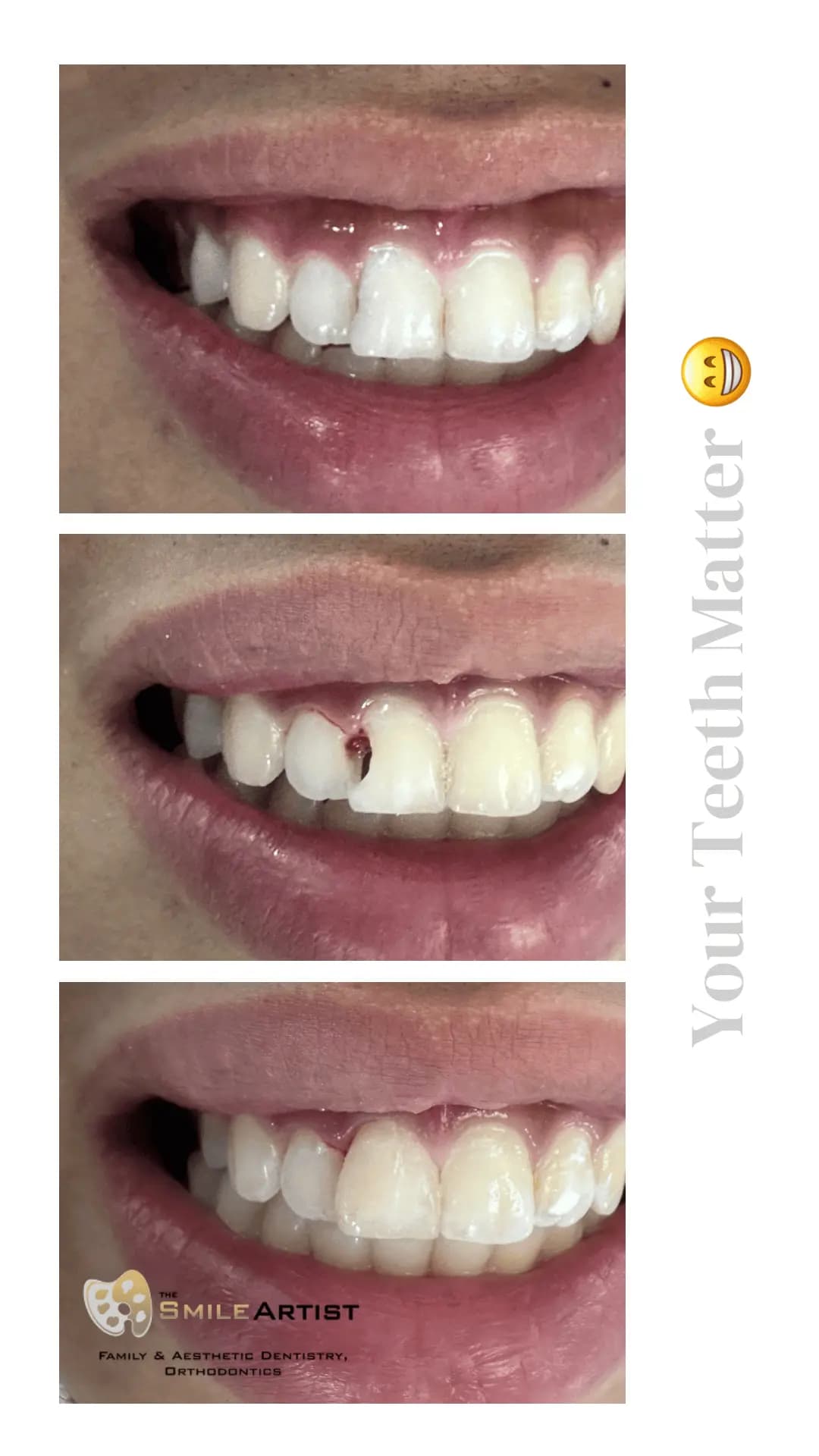 Dental Treatment Result