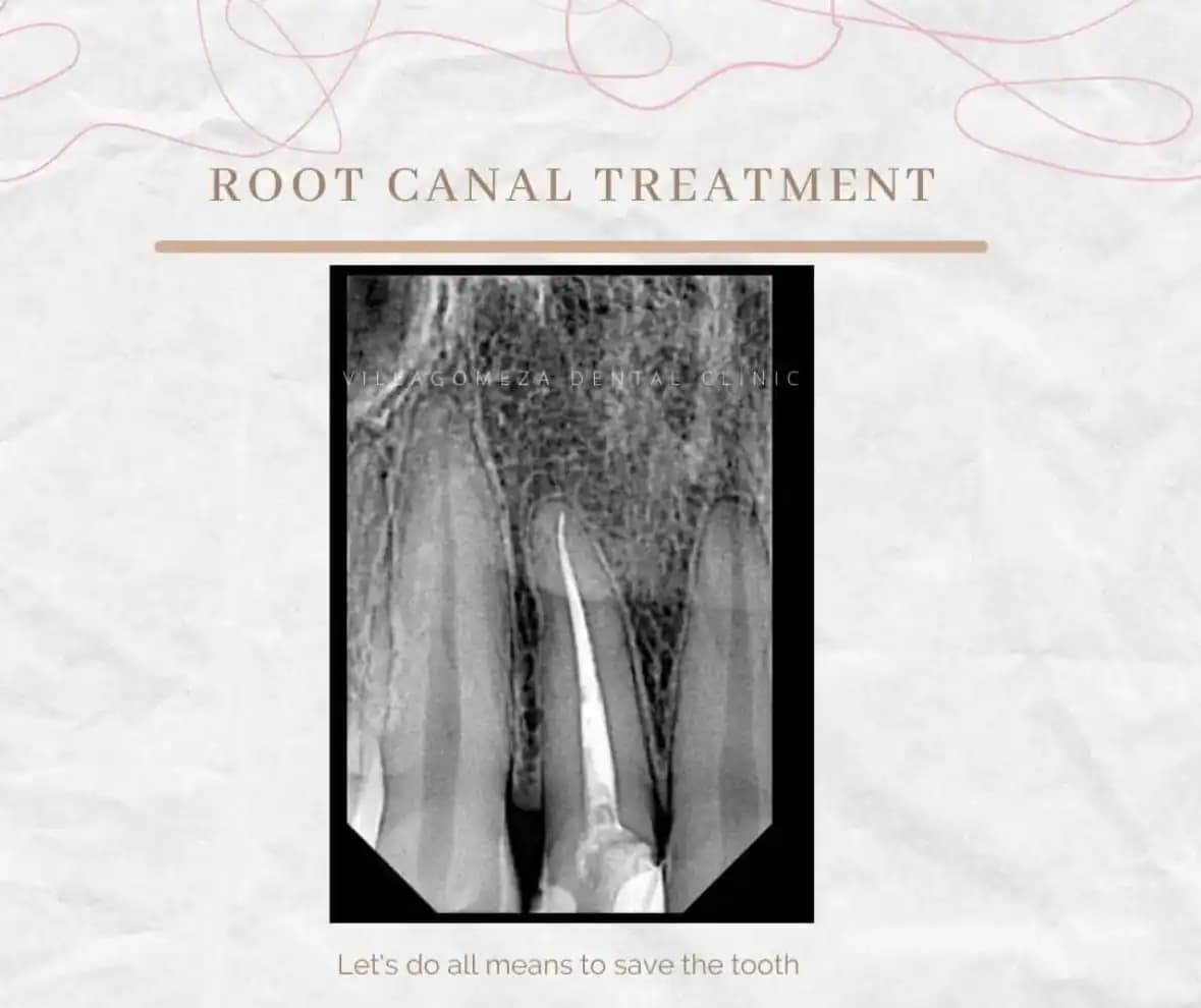 Dental Treatment Result