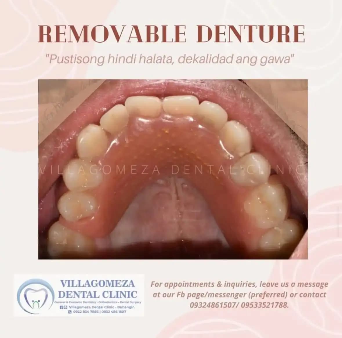 Dental Treatment Result