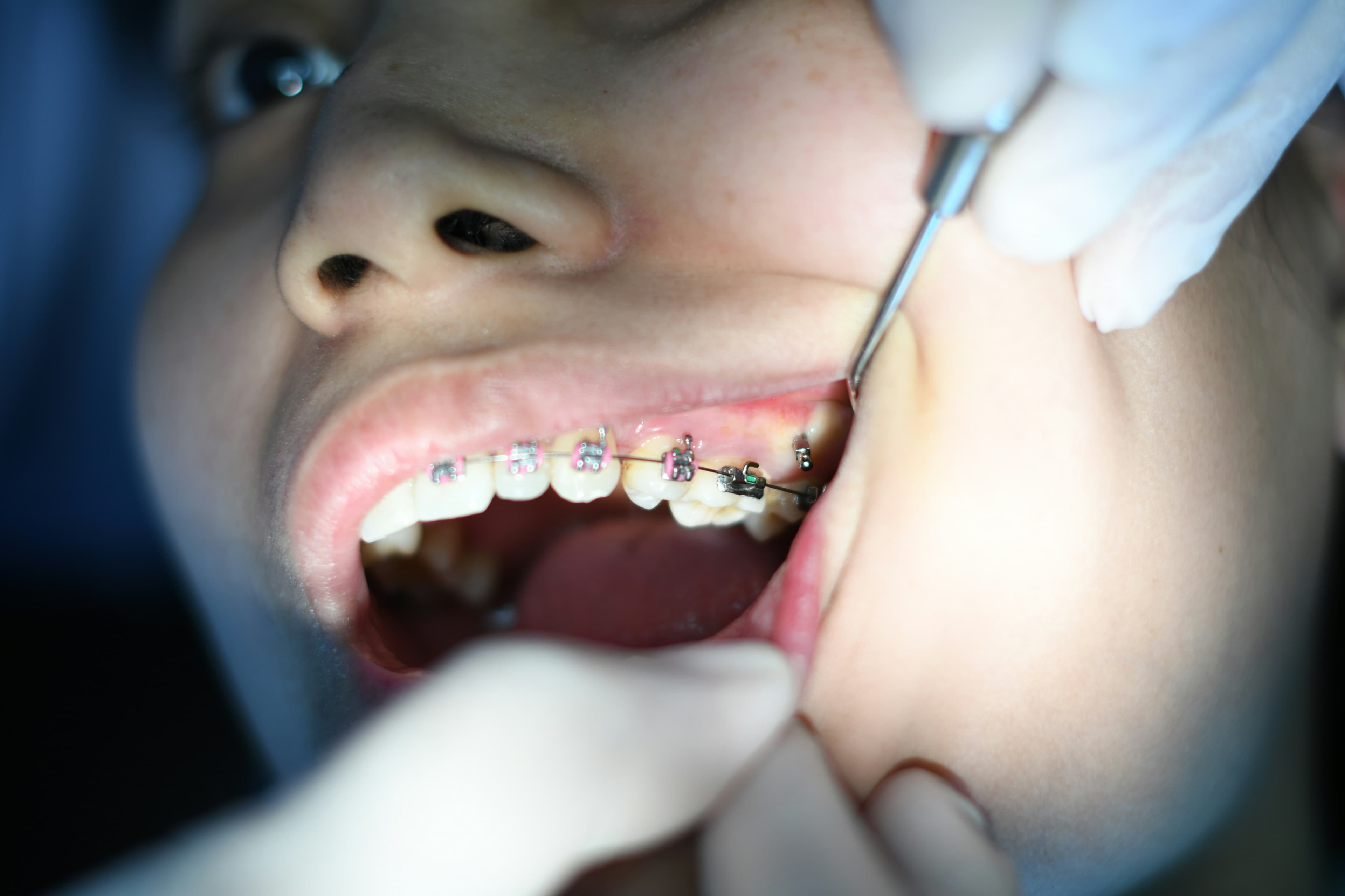 Orthodontics