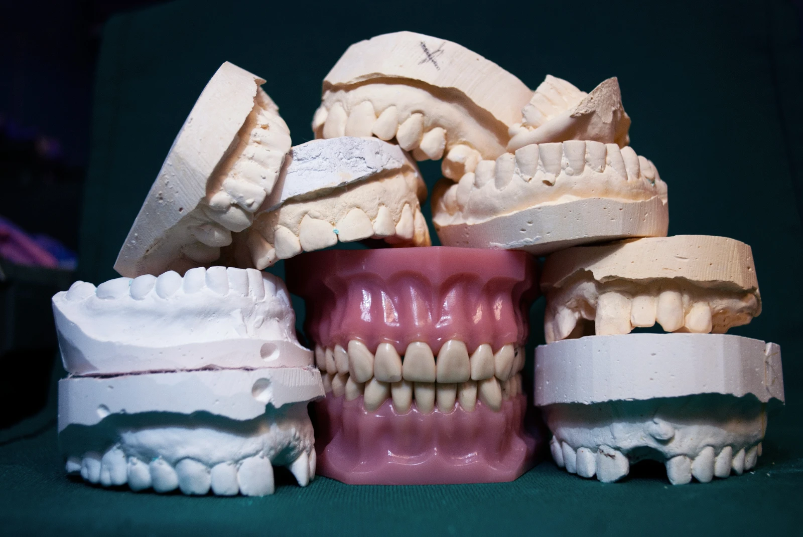 Dentures — Restorative Dentistry