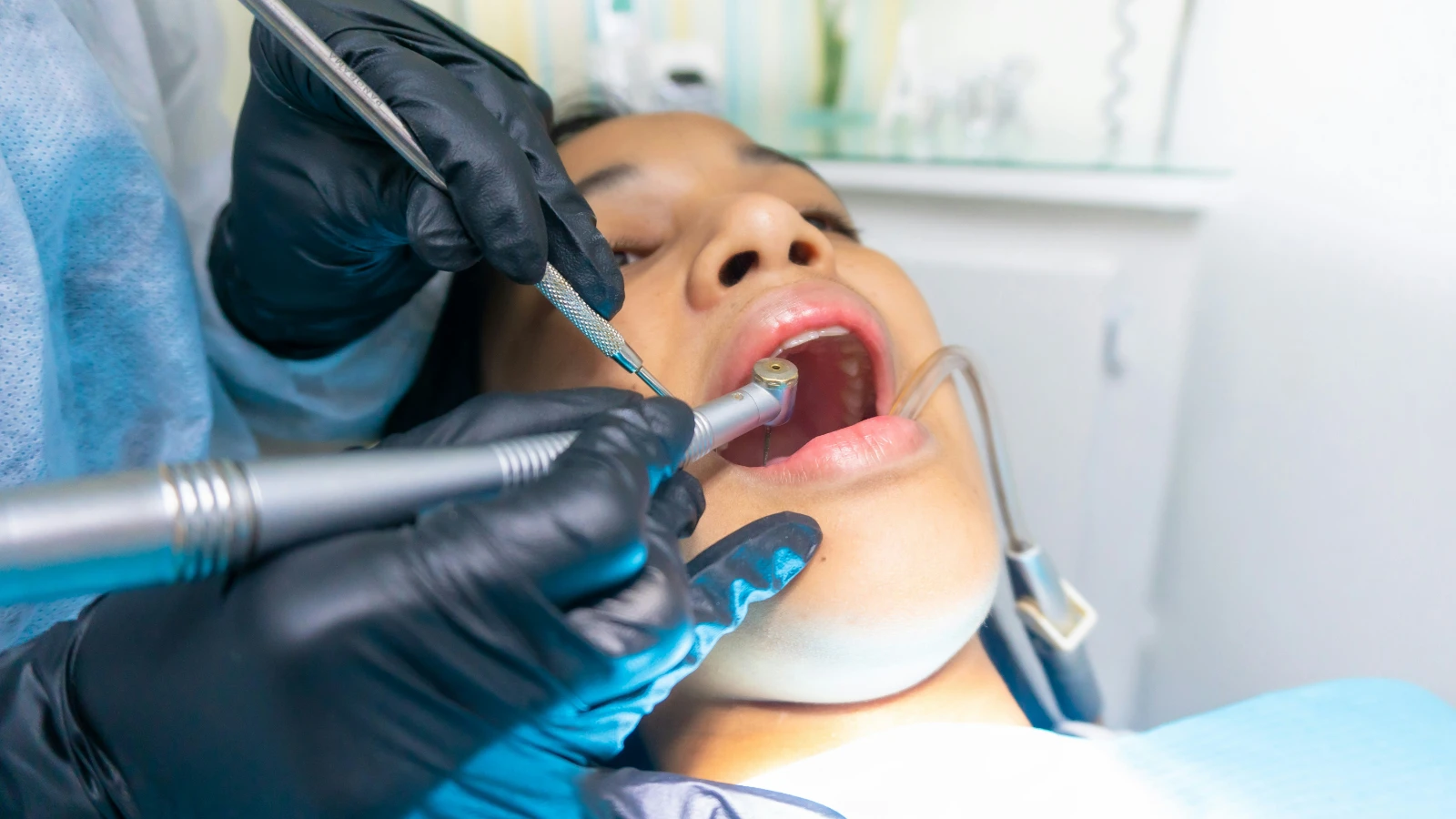 Oral Prophylaxis — Preventive Care