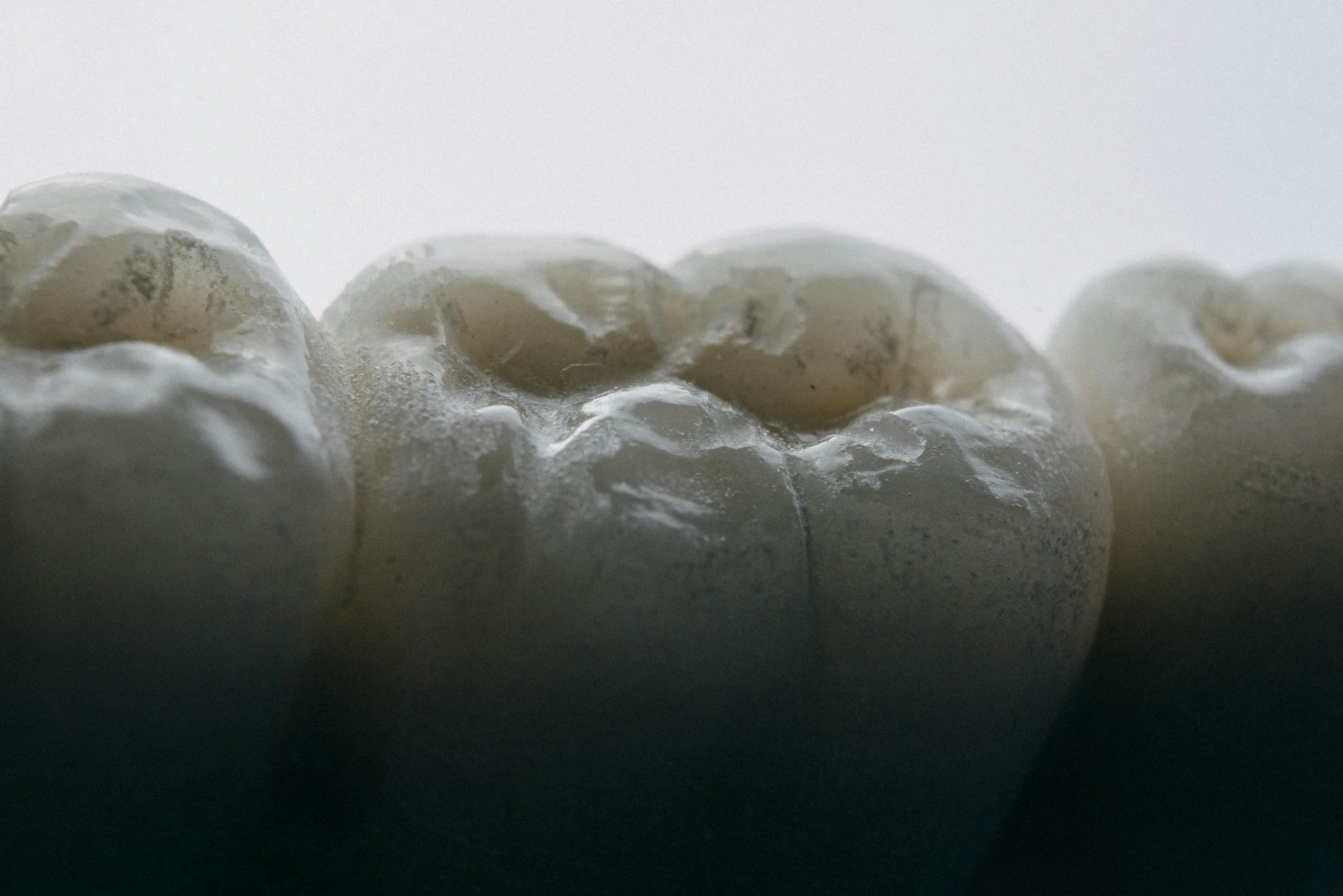Restorative Dentistry