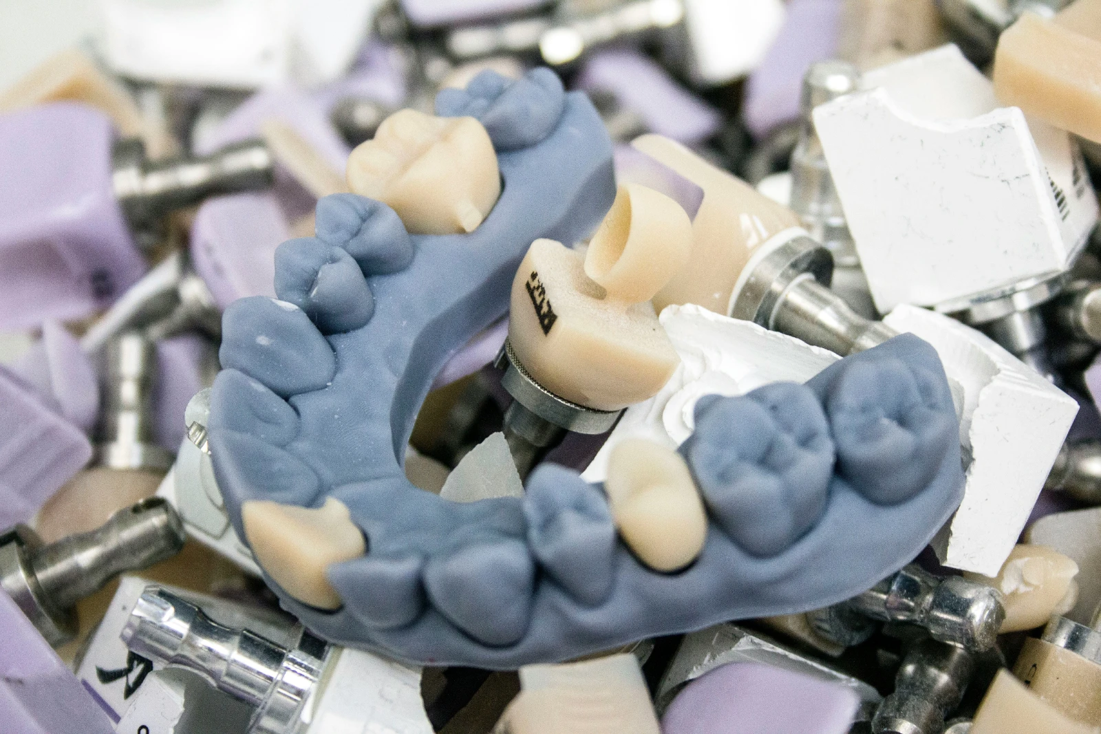 Dental Crowns & Bridges — Restorative Dentistry