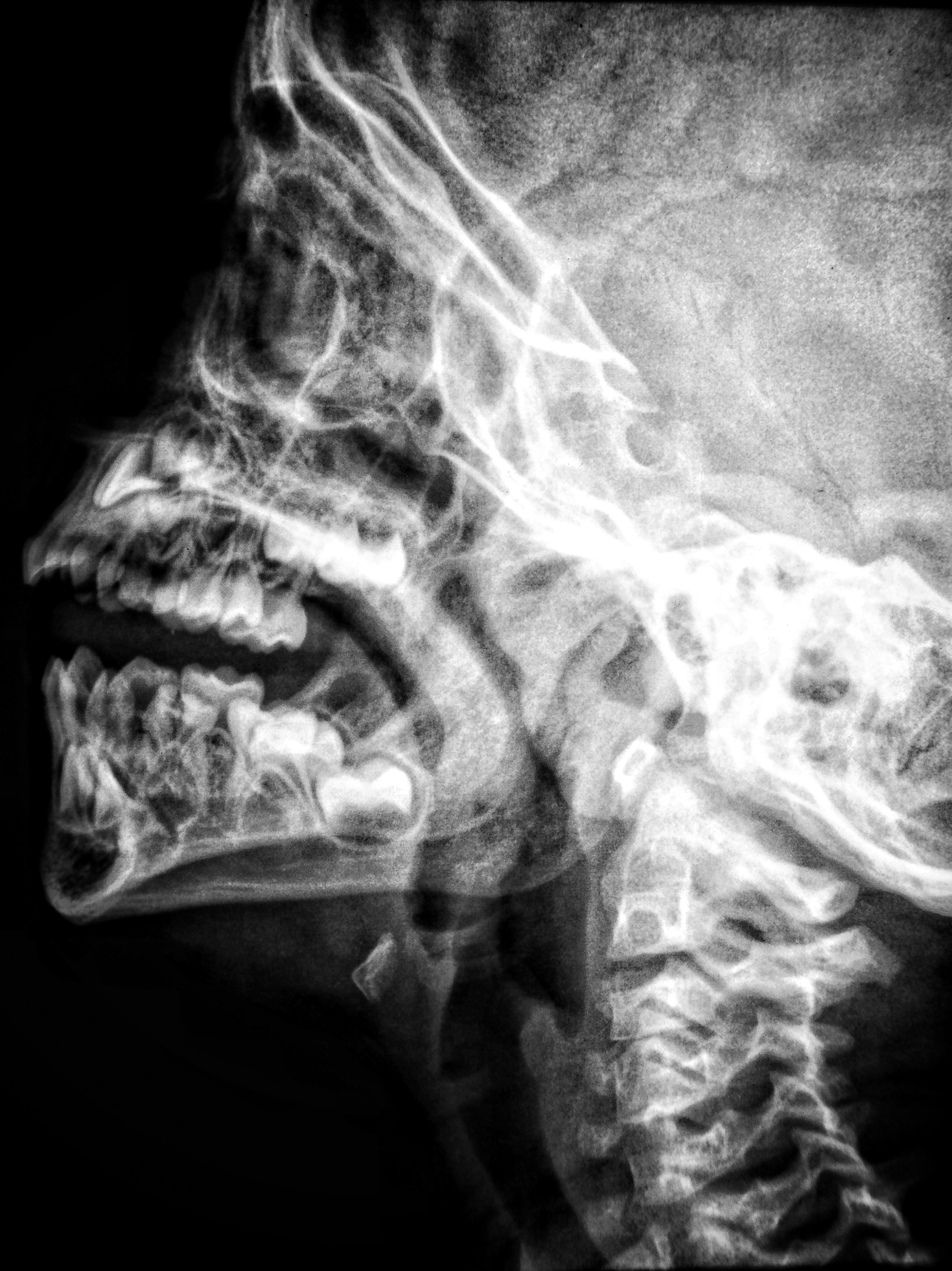 TMJ — Specialized Care